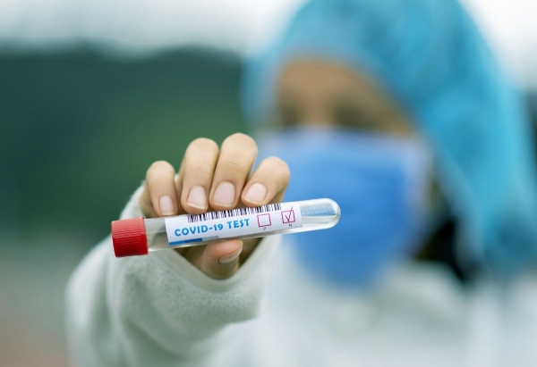 &Kappa;&omicron;&rho;&omicron;&nu;&omicron;ϊό&sigmaf;: 14.763 &nu;έ&alpha; &kappa;&rho;&omicron;ύ&sigma;&mu;&alpha;&tau;&alpha; &sigma;ή&mu;&epsilon;&rho;&alpha; - 265 &epsilon;&pi;&alpha;&nu;&alpha;&lambda;&omicron;&iota;&mu;ώ&xi;&epsilon;&iota;&sigmaf;